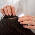 Understanding Common Scalp Issues and Their Solutions