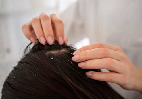 Understanding Common Scalp Issues and Their Solutions